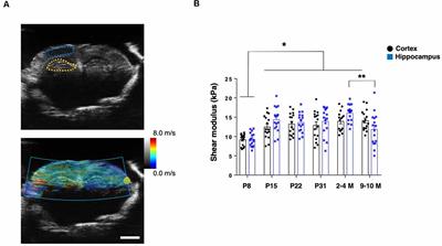 A Shift in Tissue Stiffness During Hippocampal Maturation Correlates to the Pattern of Neurogenesis and Composition of the Extracellular Matrix